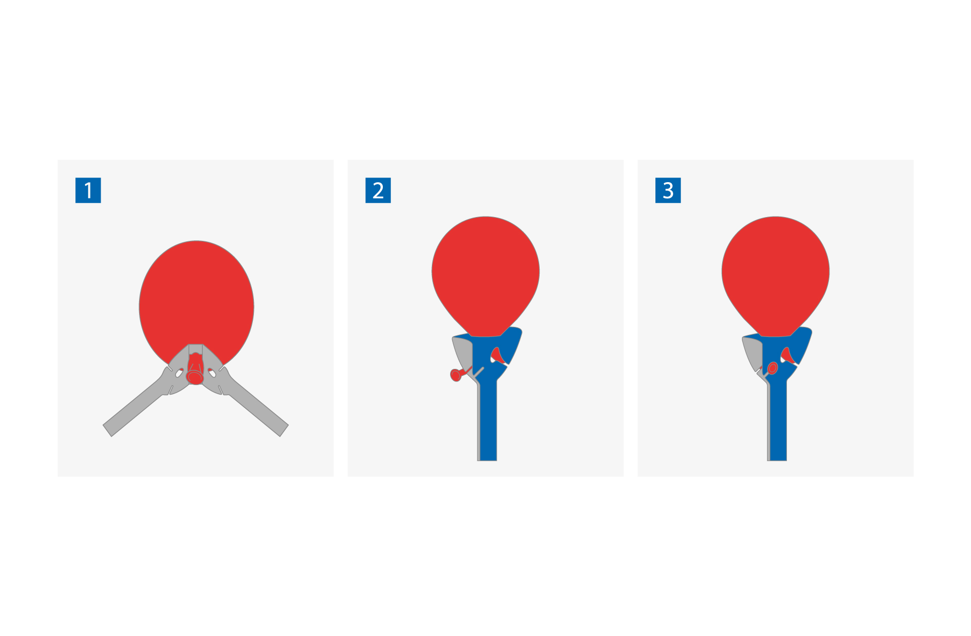 Balloon Grip Anleitung
